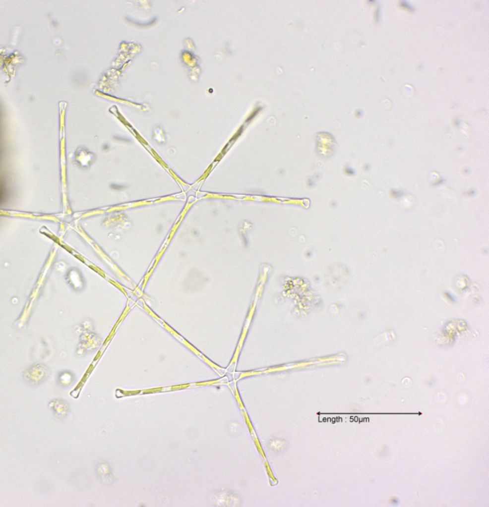 Asterionella formosa