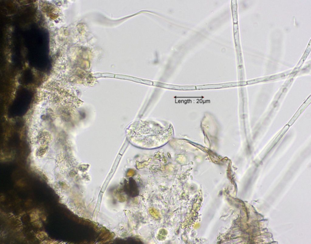 Aspidisca spec