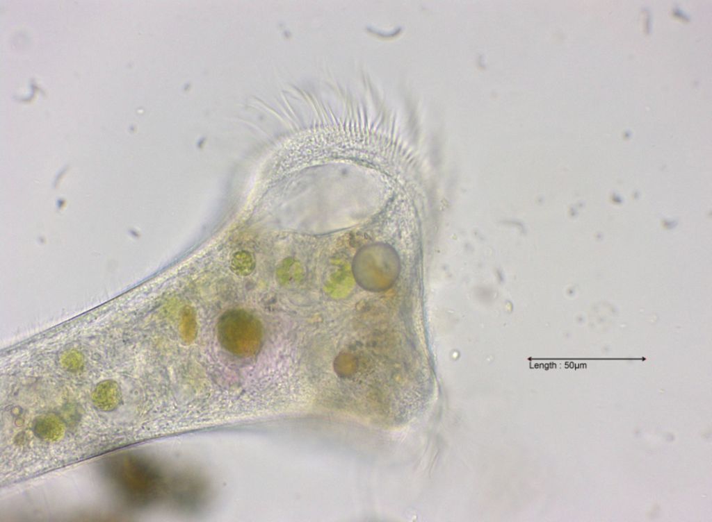 Stentor cf. igneus