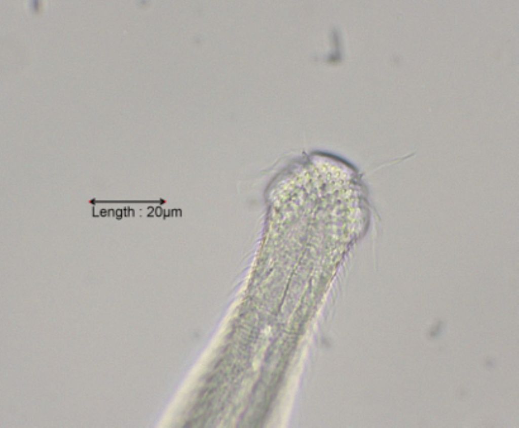 Chaetonotus maximus detail head
