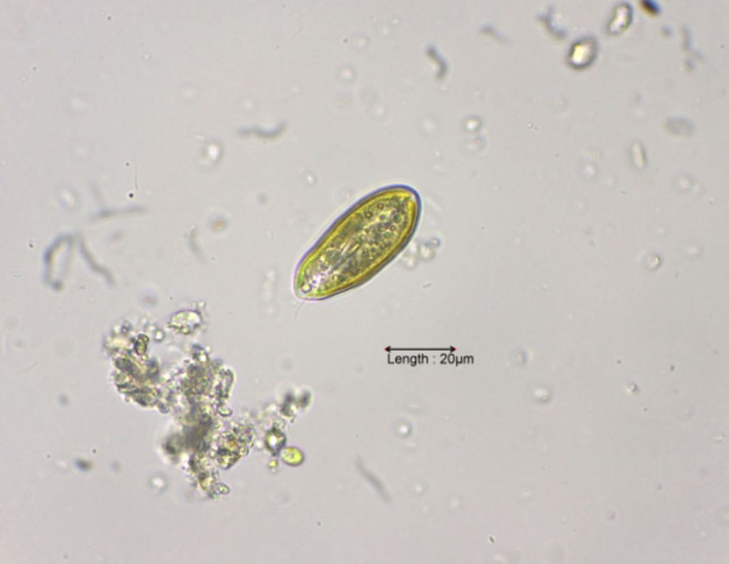 Cryptomonas cf. ovata