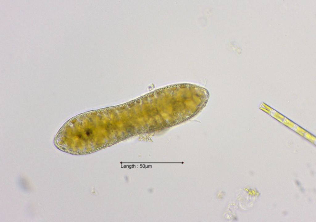 Cymatopleura solea valve view