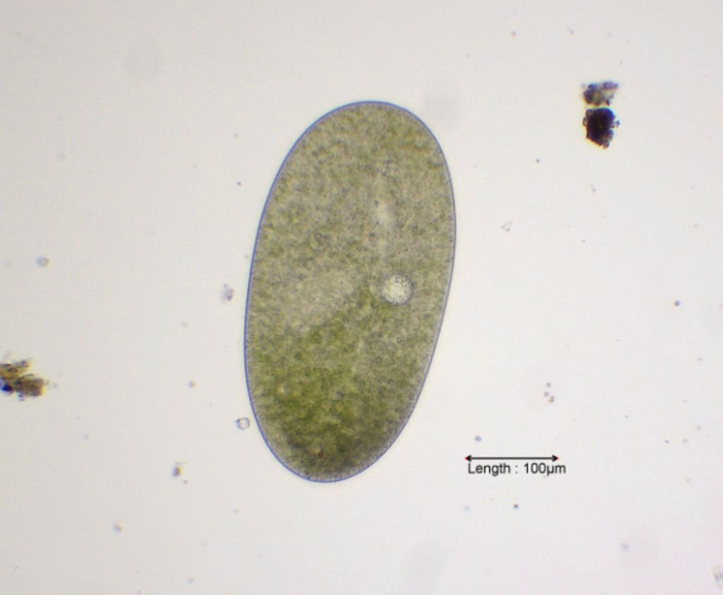 Ophryoglena atra