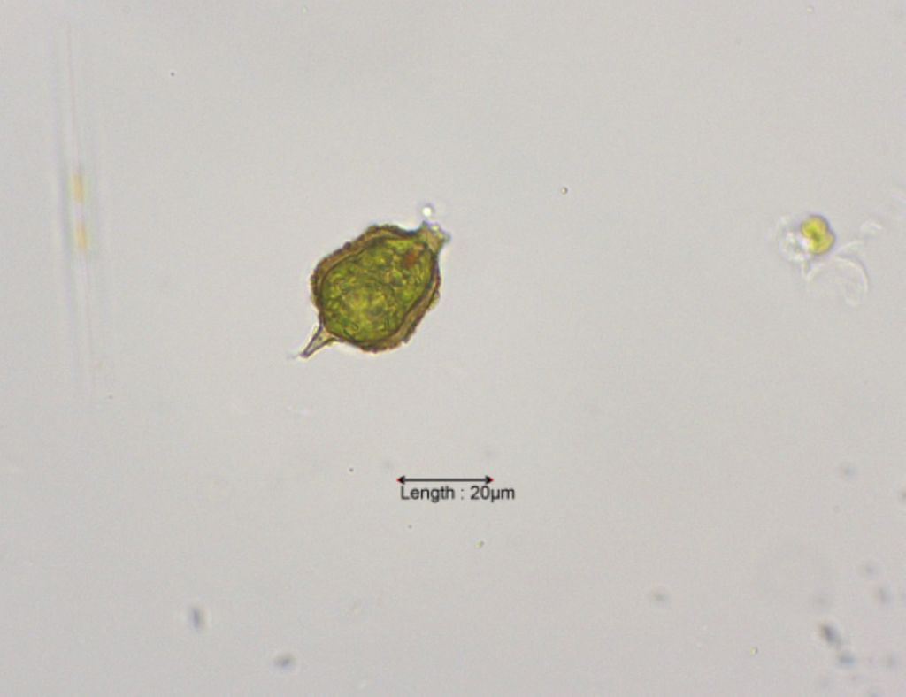 Strombomonas acuminata