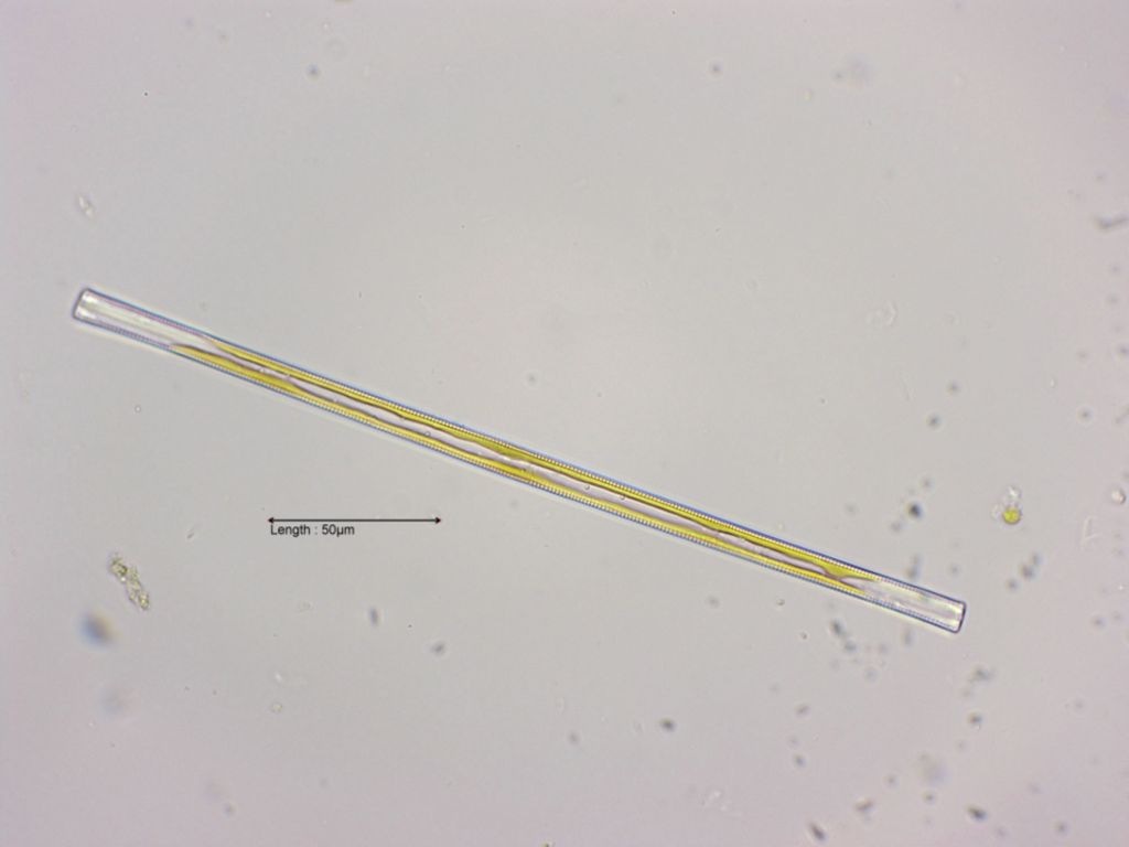 Synedra ulna girdle view