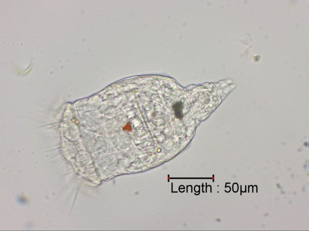 Brachionus spec