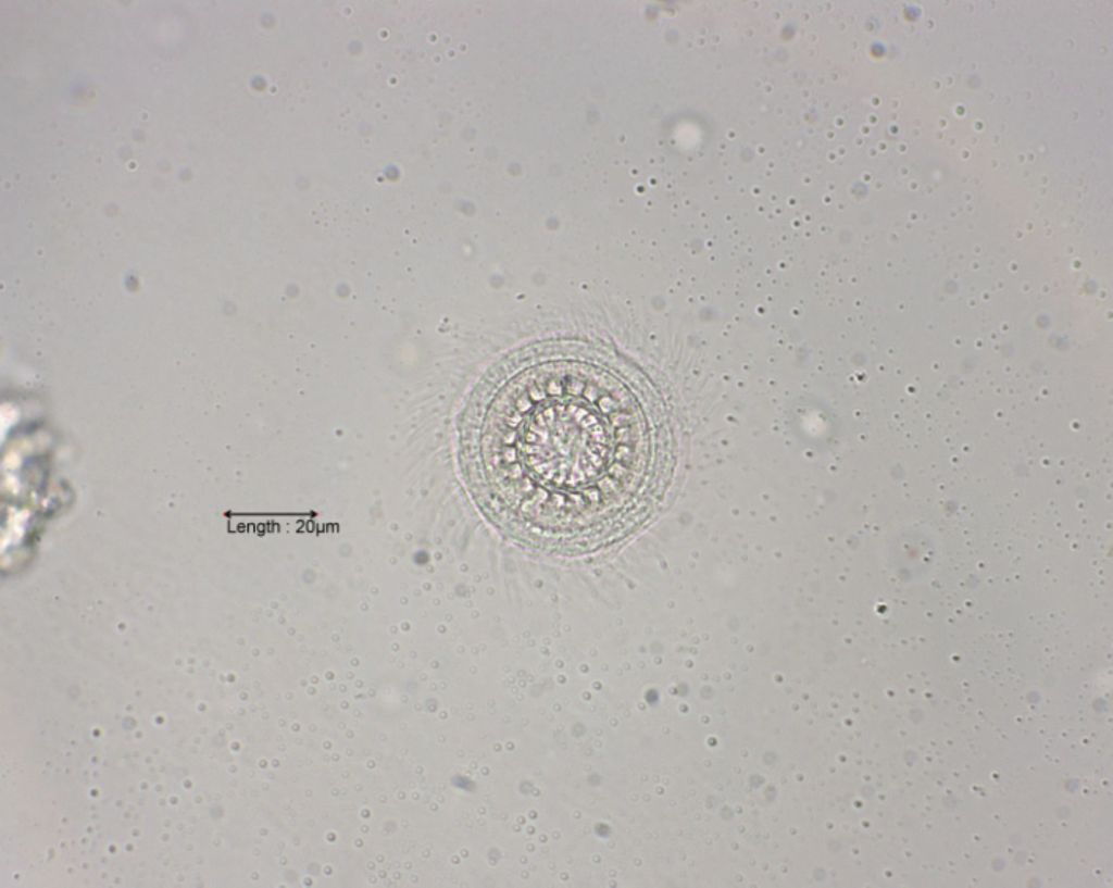 Trichodina pediculus top view