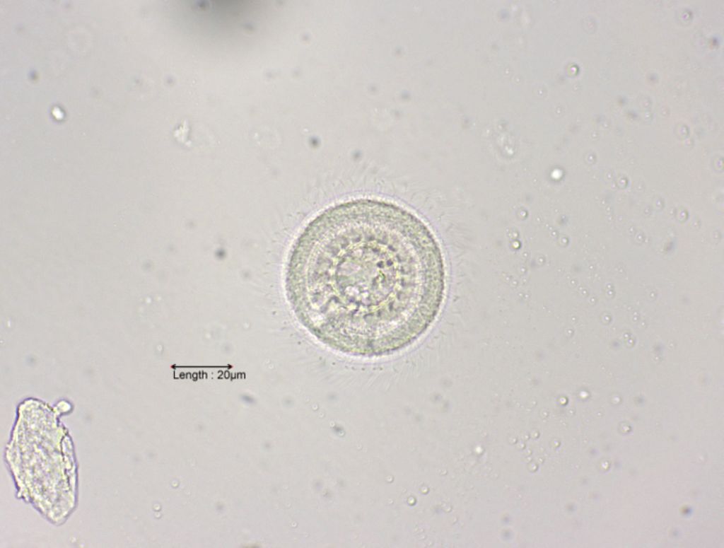 Trichodina pediculus top view