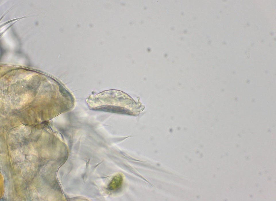 Trichodina pediculus  side view