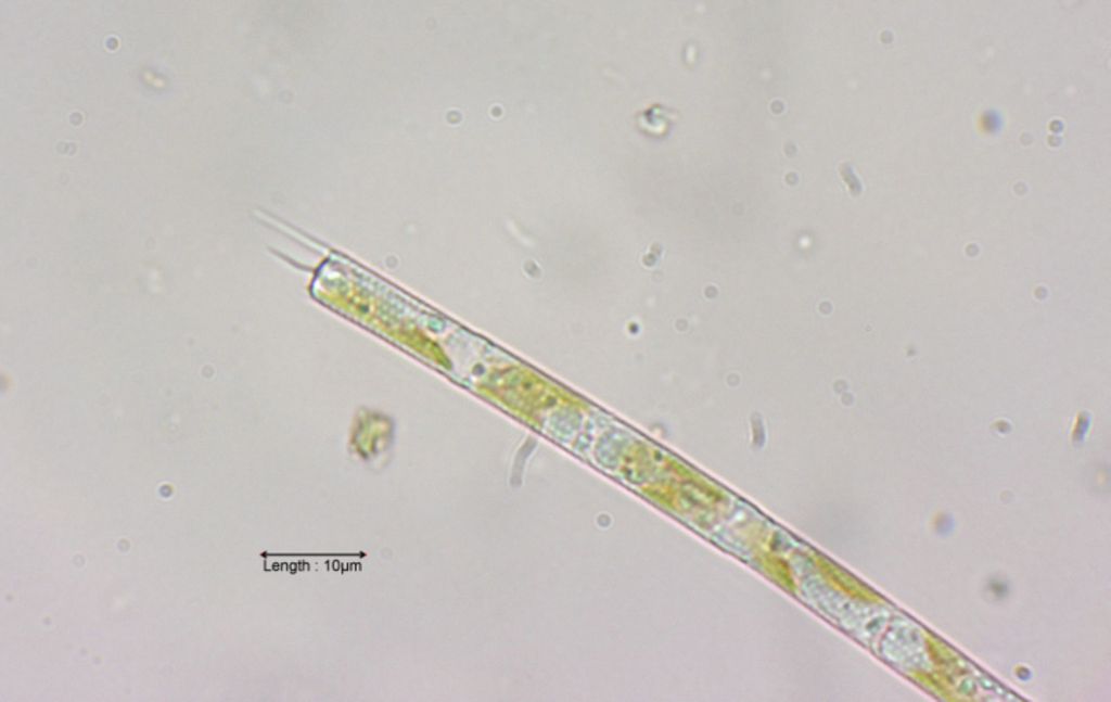 Aulacoseira granulata