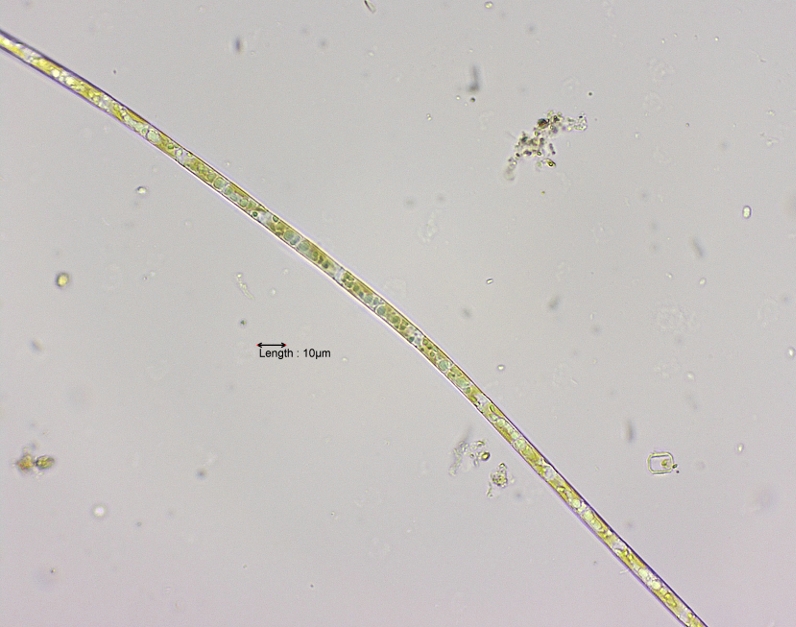 Aulacoseira granulata