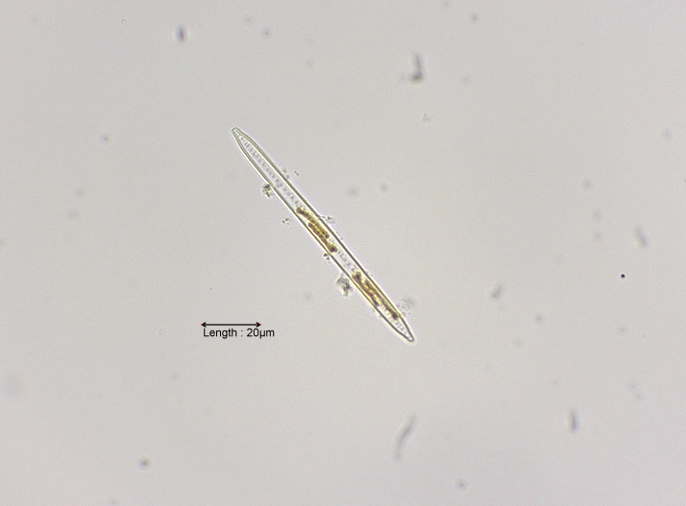 Synedra ulna valve view