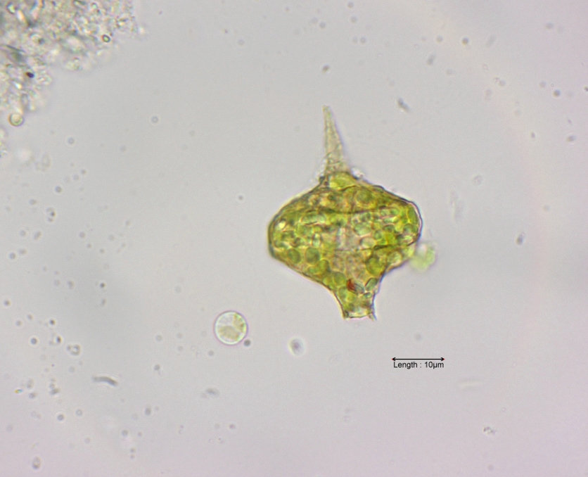 Strombomonas cf. gibberosa