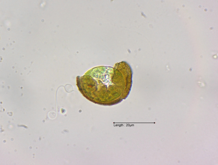 Trachelomonas spec creeping out of lorica