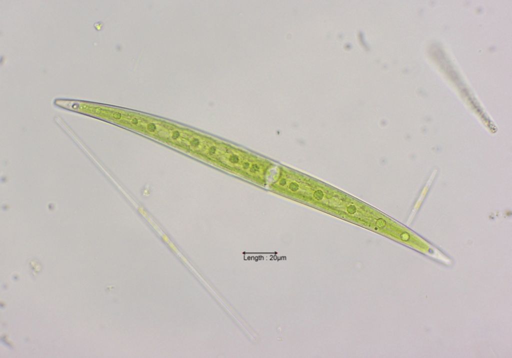Closterium cf. strigosum var. elegans