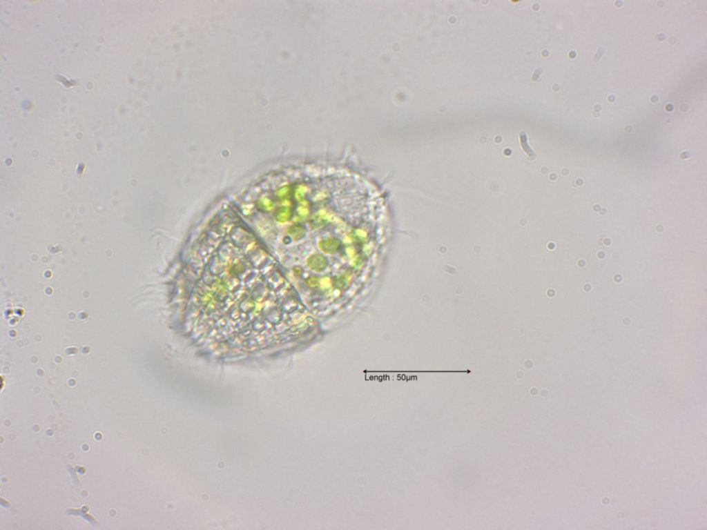 Coleps hirtus with half lorica
31-07-2023