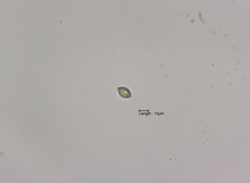 Phacotus lenticularis
31-07-2023