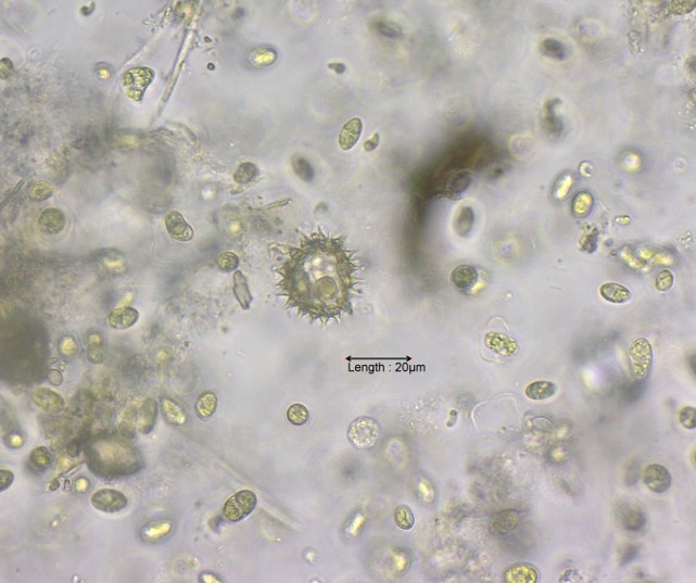 Pollen, probably Helianthus
28-08-2023