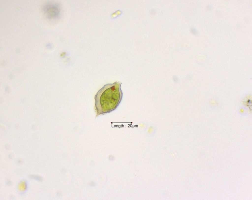 Strombomonas cf. verrucosa zmiewika
