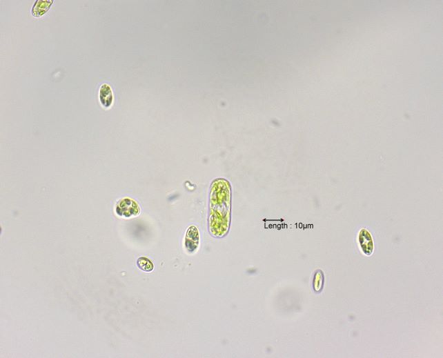 Cylindrocystis gracilis
31-10-2023