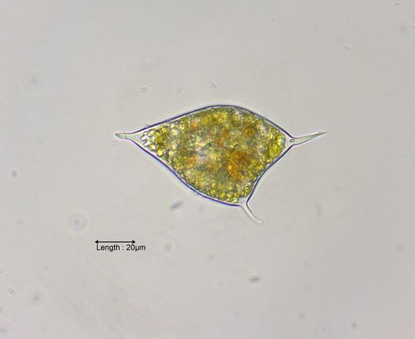Ceratium hirundella cyste