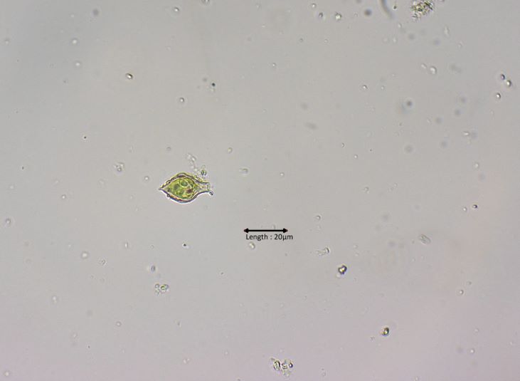 Strombomonas cf. fluviatilis