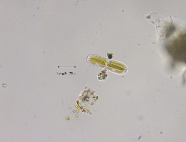 Diploneis interrupta girdle view
2024-03-23