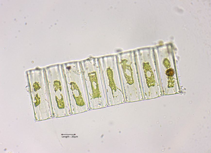 Eunotia cf. pectinalis
2024-06-06