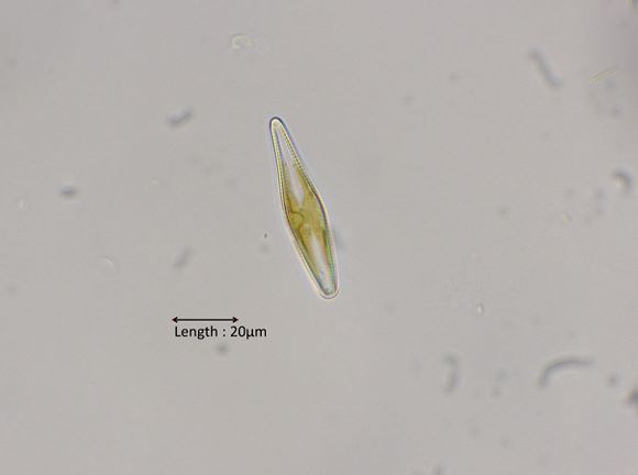 Gomphonema spec
2024-08-11