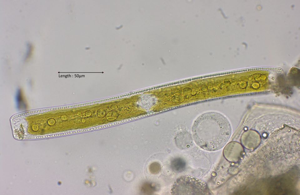 Nitzschia sigmoidea 
2024-08-11