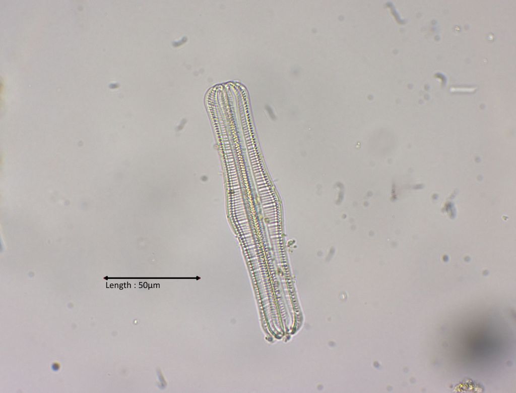 Rhopalodia spec 40x girdle view
11-08-2024