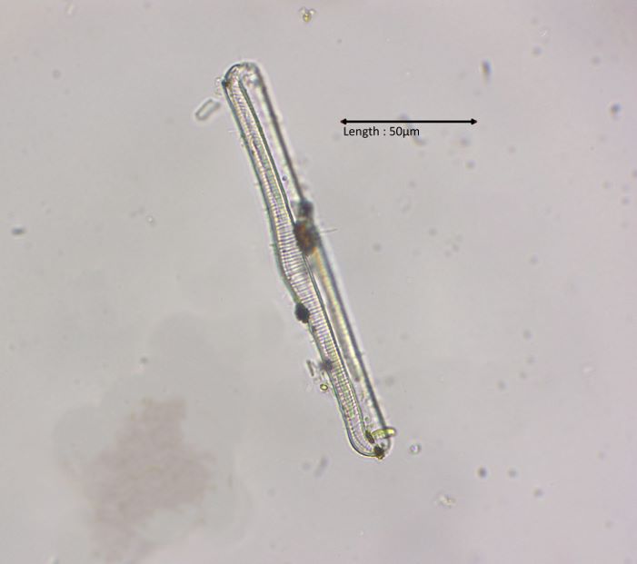 Rhopalodia spec
11-08-2024