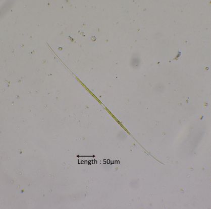 Closterium aciculare
2024-11-05