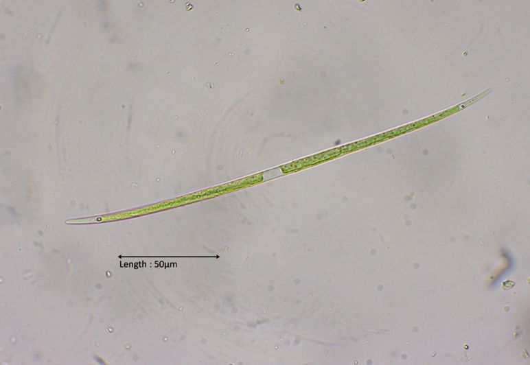 Closterium limneticum 
2024-11-03