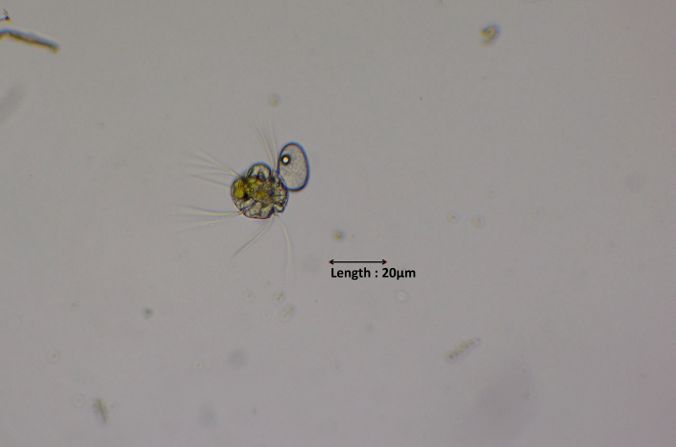 Halteria grandinella
2024-10-31


