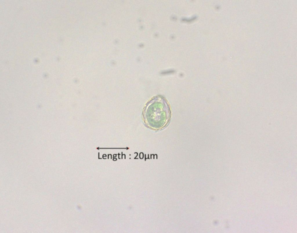 Paulinella chromatophora