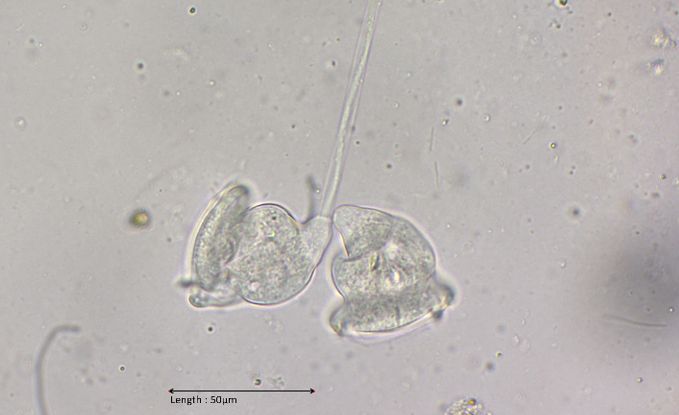 Vorticella similis