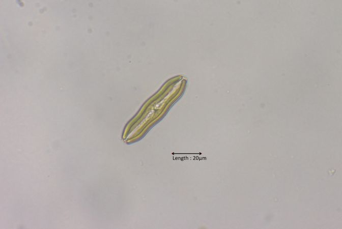 Caloneis silicula
2025-05-18