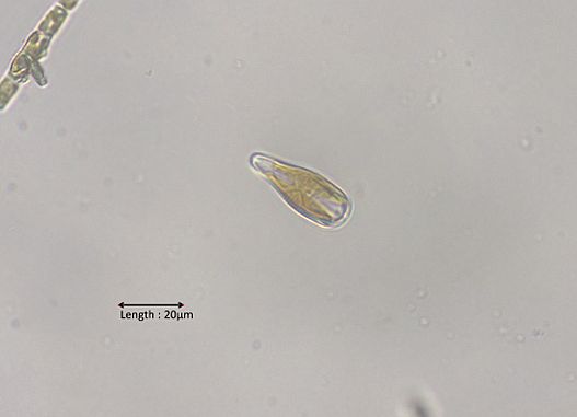 Gomphonema cf. capitatum 40x
2025-05-18