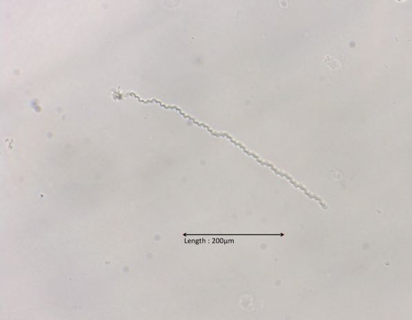 Spirochaeta spec 

