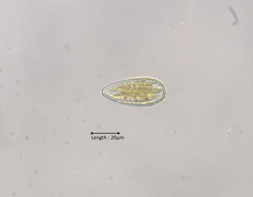 Surirella cf. ovata
2025-05-18