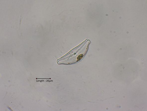 Cymbella tumida
2024-10-31