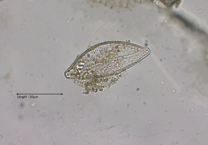 Cymbopleura inaequalis

2025-10-31