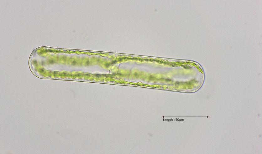 Netrium cf. oblongum
2022-06-22