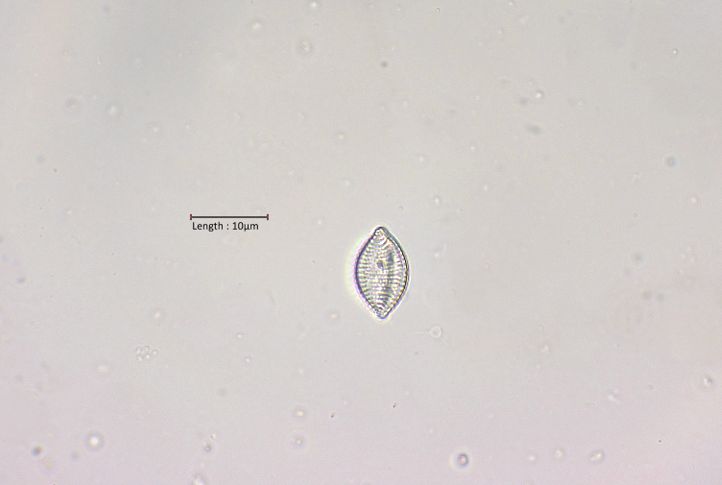 Rhaphoneis cf. amphiceros var. minor