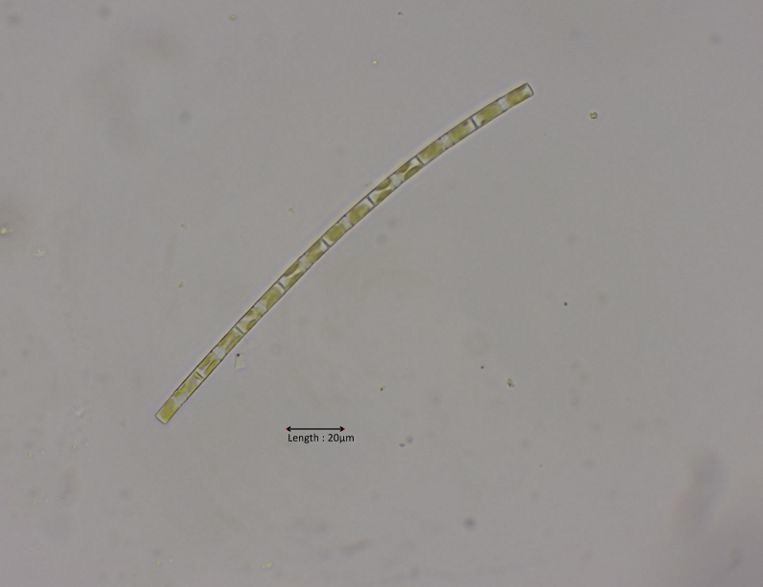 Tribonema cf. minus 40x
2024-10-31