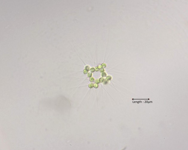 Micractinium quadrisetum