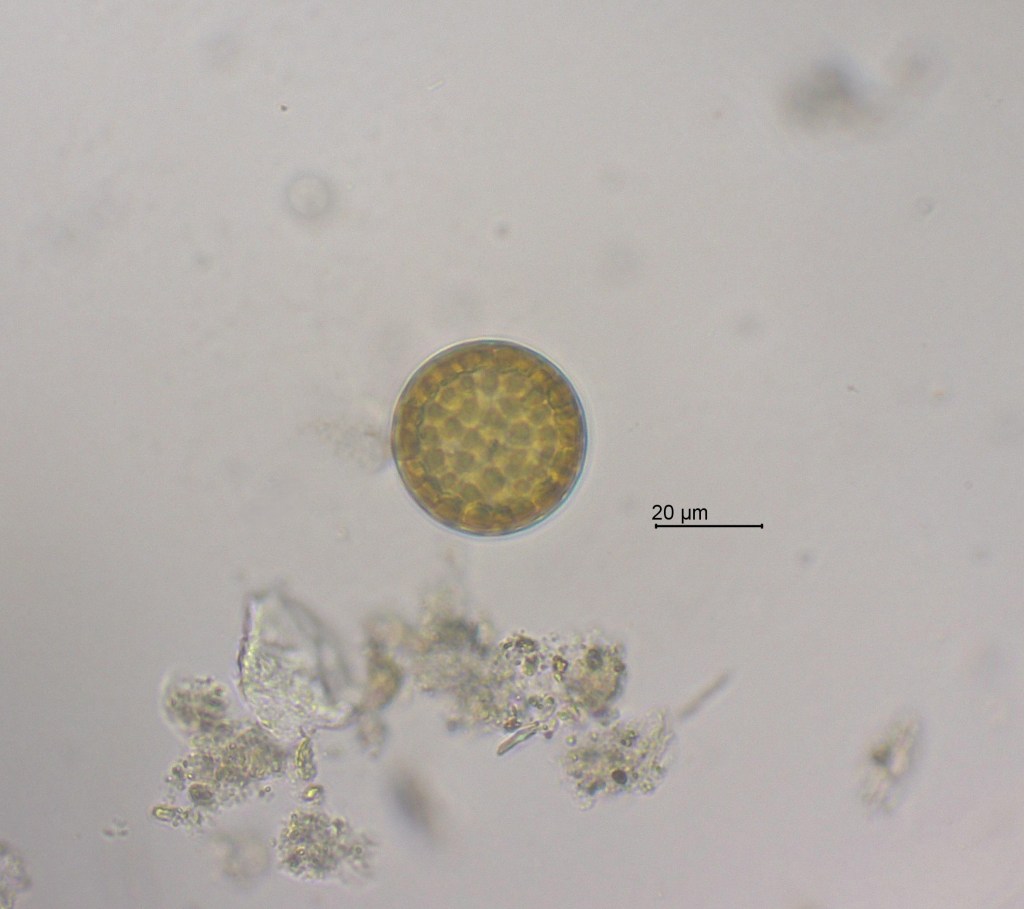 Actinocyclus curvatulus