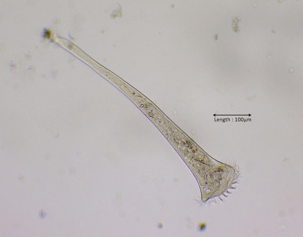 Stentor roeselli
30-10-2025